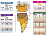 Ultradent Composite Shade